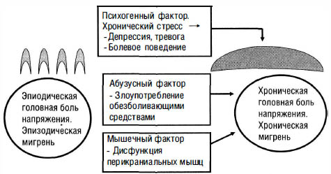 Основные факторы хронизации головной боли напряжения и мигрени